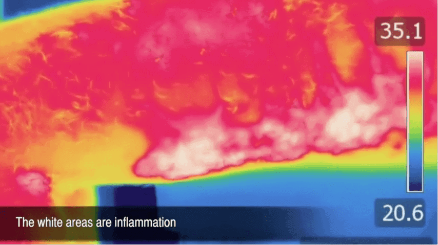 Thermographic image showing the blow from a single whip strike. Several areas indicating inflammation